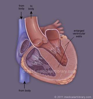 left ventricle image.jpg 2.jpg